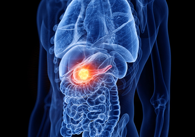 Pancreatic Cancer Organoid Kit